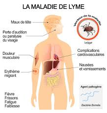 maladie de Lyme
